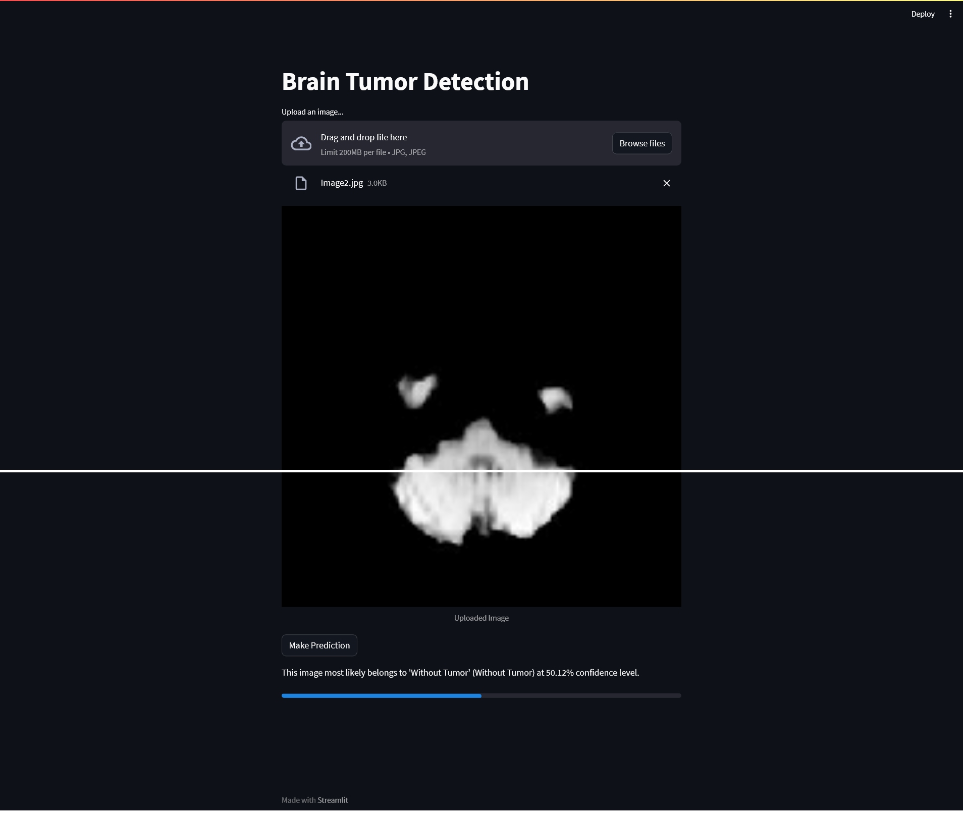 Neurological Disorder Detection
